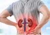 Suy thận trẻ hóa: Nhiều người 20 tuổi đã đối mặt nguy cơ chạy thận