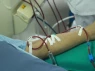 Người trẻ ngày càng mắc suy thận: Bác sĩ cảnh báo 3 dấu hiệu sớm dễ bị bỏ qua
