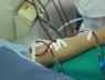 Người trẻ ngày càng mắc suy thận: Bác sĩ cảnh báo 3 dấu hiệu sớm dễ bị bỏ qua