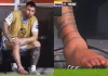Chân của Messi bị làm sao vậy?