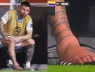 Chân của Messi bị làm sao vậy?