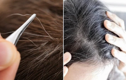 Nhổ một sợi tóc bạc có thể kích thích nhiều sợi tóc bạc khác, điều này có đúng không?