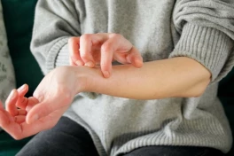 5 cảnh báo bệnh gan biểu hiện ngay trên da