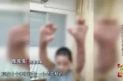 Một người phụ nữ bị bỏng nặng khắp cơ thể, bao gồm cả mười ngón tay, khi đang dùng điện thoại sạc pin trên giường