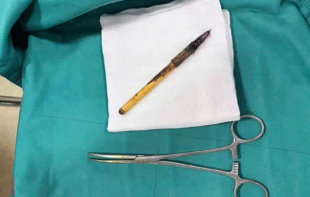 Vụ nam sinh lớp 6 phải phẫu thuật lấy bút trong trực tràng: Sức khỏe đã cải thiện, cơ quan chức năng tiếp tục làm rõ