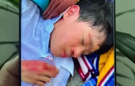 Sốc! Hà Nội: Nam sinh lớp 6 nghi bị bạn nhét bút bi vào vùng nhạy cảm, công an mời các bên liên quan làm việc
