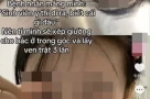 Nữ sinh Đại học Y Hà Nội bị xem xét kỷ luật sau phát ngôn “lấy ven trật 3 lần” với bệnh nhân