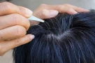 Đừng lo lắng tóc bạc sẽ khiến bạn trông già! Tóc bạc có thể là dấu hiệu cho thấy cơ thể bạn đang cố gắng làm điều này