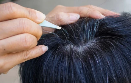 Đừng lo lắng tóc bạc sẽ khiến bạn trông già! Tóc bạc có thể là dấu hiệu cho thấy cơ thể bạn đang cố gắng làm điều này