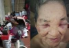 Nuôi con khôn lớn, tuổi 82 lại sống trong sợ hãi: Bi kịch phía sau vụ con gái hành hạ mẹ già