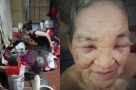Nuôi con khôn lớn, tuổi 82 lại sống trong sợ hãi: Bi kịch phía sau vụ con gái hành hạ mẹ già