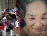 Nuôi con khôn lớn, tuổi 82 lại sống trong sợ hãi: Bi kịch phía sau vụ con gái hành hạ mẹ già