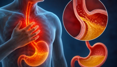 Trào ngược dạ dày thực quản gây hôi miệng phải làm gì?