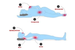 Những tư thế ngủ có thể gây hại sức khỏe