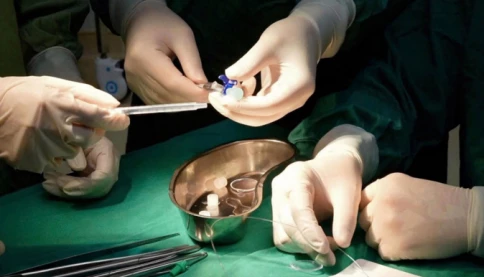 Lần đầu tiên bác sĩ Việt Nam thực hiện thành công kỹ thuật FETO, mở cơ hội sống cho thai nhi mắc thoát vị hoành bẩm sinh