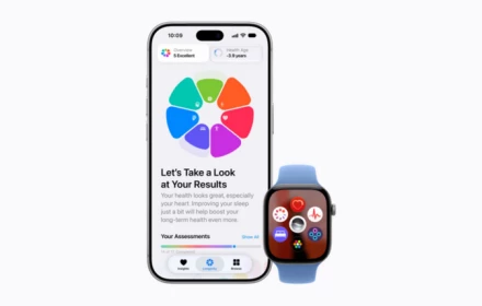 Apple Watch Series 12 dùng với iPhone nào và cần kiểm tra gì?