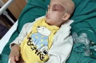Bé trai 6 tuổi bị chấn thương sọ não khi gửi tại cơ sở can thiệp ở Hà Nội: Tỷ lệ tổn thương 39%