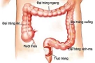 Nam sinh 22 tuổi mắc ung thư đại tràng giai đoạn 4 sau khi bỏ qua 3 dấu hiệu bất thường suốt nửa năm