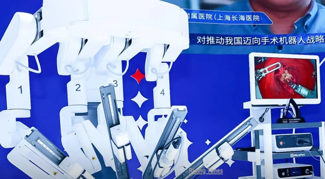 thumbnail - Trung Quốc chế tạo robot 4 tay tích hợp AI để giúp bác sĩ phẫu thuật