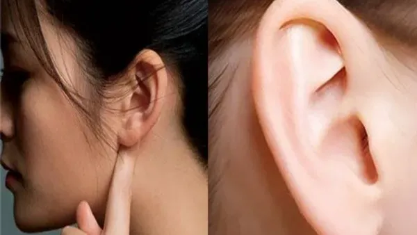 thumbnail - Sự khác biệt giữa "tai nghèo" và "tai giàu" là gì, hãy xem bạn có tướng tai như thế nào?