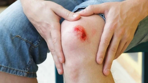 6 bước chăm sóc vết thương hở mau lành