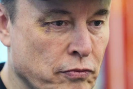 Elon Musk xuất hiện với mắt bầm tím trong ngày chia tay chính quyền ông Trump, tiết lộ "thủ phạm" không ai ngờ đến