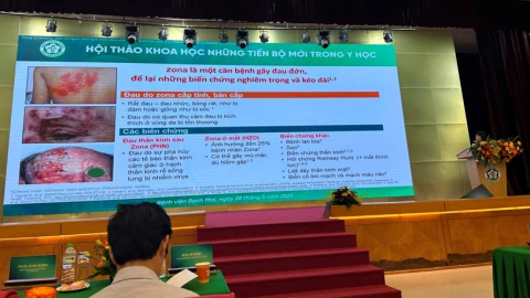 Vắc xin - Lá chắn phòng bệnh Zona hiệu quả cho người cao tuổi, người có bệnh nền
