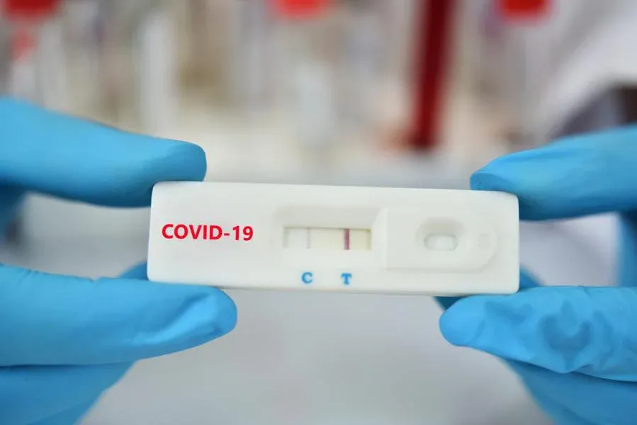 Vạch kit test Covid-19 lúc mờ lúc đậm có ý nghĩa gì?