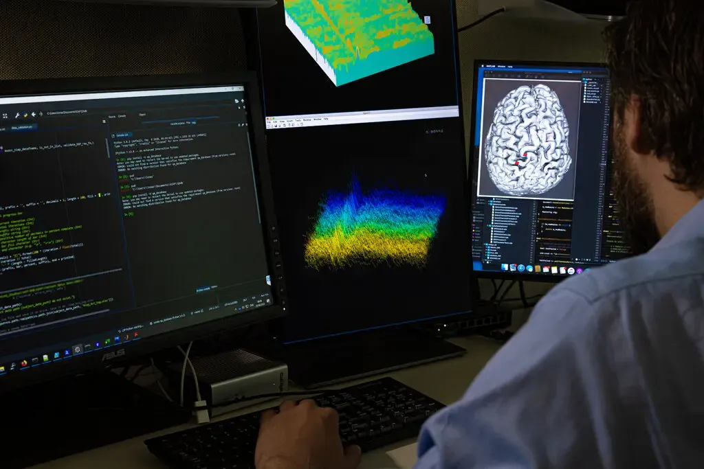 Cấy ghép chip não: Giải pháp giúp bệnh nhân bị liệt hoàn toàn có thể giao tiếp bằng suy nghĩ
