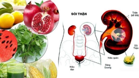 Bệnh nhân sỏi thận nên ăn gì để nhanh chóng đẩy lùi bệnh?