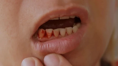 9 dấu hiệu "ngấm ngầm" cảnh báo tiểu đường ở nam giới