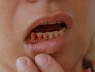 9 dấu hiệu "ngấm ngầm" cảnh báo tiểu đường ở nam giới