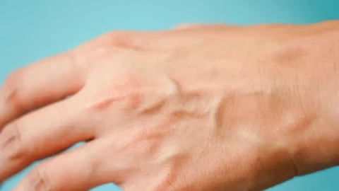 Tại sao một số người lại có gân xanh ở tay? Hãy cẩn thận nếu bạn có gân xanh ở những vị trí này