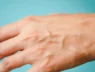 Tại sao một số người lại có gân xanh ở tay? Hãy cẩn thận nếu bạn có gân xanh ở những vị trí này