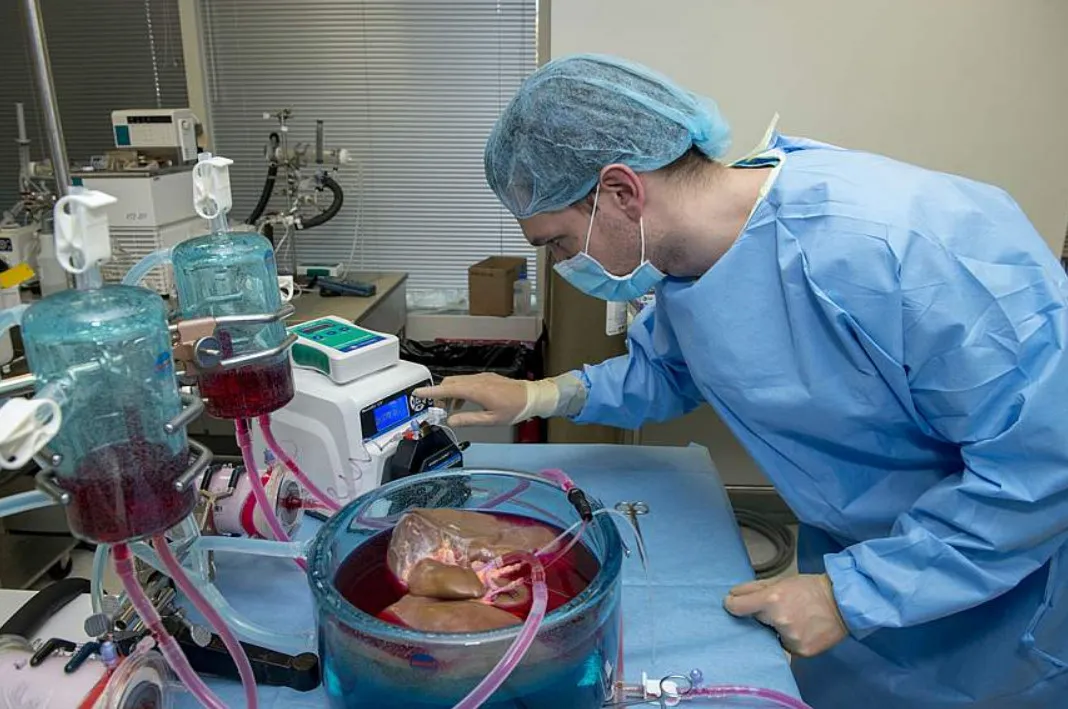 Các bác sỹ lần đầu tiên cấy ghép gan người được bảo quản bên ngoài cơ thể trong 3 ngày
