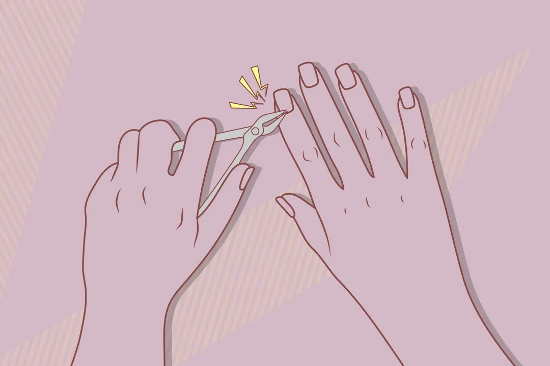 thumbnail - Có nên cắt da móng tay không?