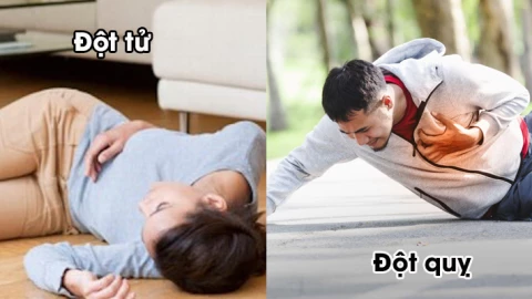 Từ trường hợp ông Hoàng Nam Tiến qua đời, phân biệt đột tử và đột quỵ thế nào?