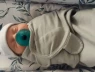 Phôi thai 31 năm được sinh ra: Câu hỏi lớn cho công nghệ hỗ trợ sinh sản