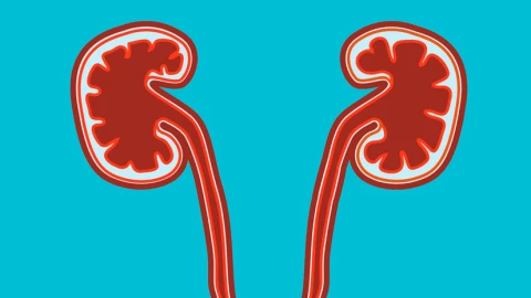 7 thói quen của người bị sỏi thận, bạn có đang có những thói quen này ?