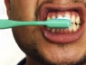 Tại sao một loại protein quen thuộc trong tóc và móng lại có thể giúp răng tự tái tạo?