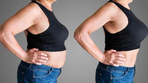 Chạy theo giảm cân để có vóc dáng thon gọn nhưng ít ai biết có 1 loại gầy đặc biệt còn đáng sợ hơn béo phì cả chục lần