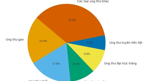5 loại ung thư đàn ông Việt mắc nhiều nhất