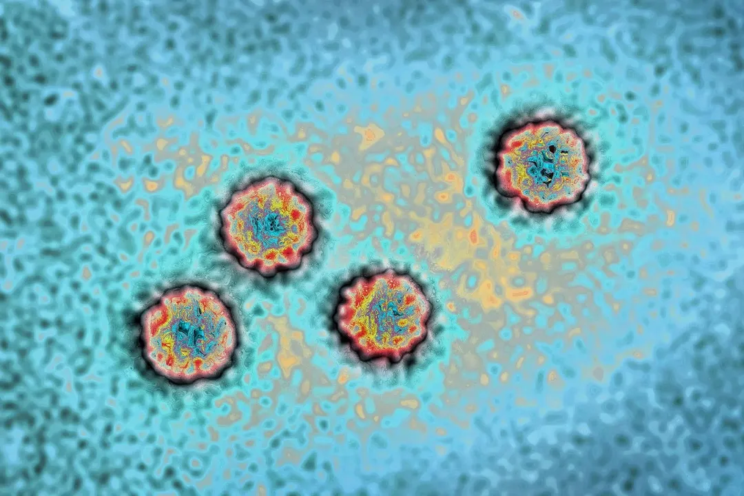5 điều cần biết về bệnh viêm gan bí ẩn đang lây lan