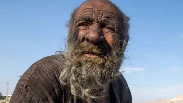 thumbnail - 'Người đàn ông bẩn nhất thế giới' qua đời ở tuổi 94 vài tháng sau lần tắm gội đầu tiên