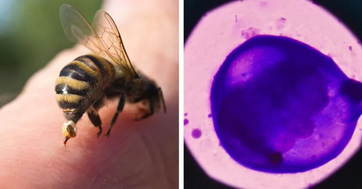 Phát hiện mới: Nọc độc ong mật có thể tiêu diệt tế bào ung thư vú