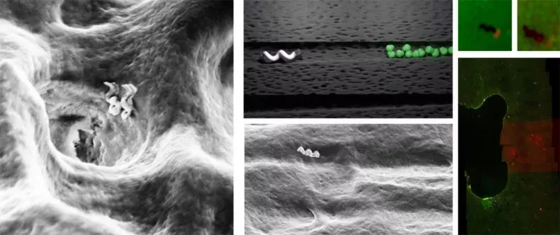 Nghiên cứu thành công robot kích thước nano tiêu diệt vi khuẩn trong tủy răng
