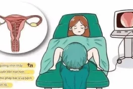 Mổ nội soi cắt u xơ tử cung được thực hiện như thế nào?