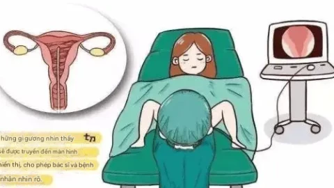 Mổ nội soi cắt u xơ tử cung được thực hiện như thế nào?