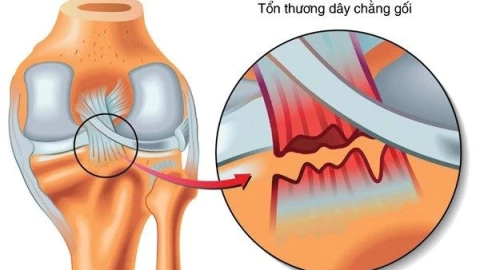 Rách dây chằng có liền lại không?