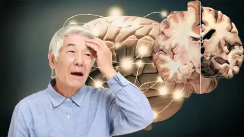 10 dấu hiệu tưởng nhỏ nhưng có thể là lời cảnh báo sớm của Alzheimer